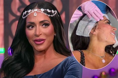 angelina pivarnick acne|Jersey Shore Angelina Pivarnick looks unrecognizable。